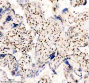 Immunohistochemical staining of FFPE human placental tissue with TBX5 antibody, HRP-secondary and DAB substrate. HIER: boil tissue sections in pH8 EDTA for 20 min and allow to cool before testing.