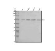 Western blot analysis of TBX5 using anti-TBX5 antibody. Human whole cell lysates from HeLa, HepG2, MCF-7, and U2OS cells were resolved by 10% SDS-PAGE under reducing conditions and transferred to a nitrocellulose membrane. TBX5 was detected as a prominent band migrating at approximately 65-70 kDa across all tested cell lines. The predicted molecular weight of TBX5 based on amino acid sequence is approximately 58 kDa; the higher apparent molecular weight observed on SDS-PAGE is consistent with reported behavior of T-box transcription factors and may reflect post-translational modifications, altered SDS binding, or conformational properties that affect electrophoretic mobility rather than a difference in primary sequence.