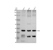 Western blot analysis of FFAR2 using anti-FFAR2 antibody. Proteins from whole cell lysates were separated by 10% SDS-PAGE and transferred to a nitrocellulose membrane. Lane 1: human THP-1 whole cell lysates; Lane 2: human HeLa whole cell lysates; Lane 3: human MCF-7 whole cell lysates. A predominant band is detected at approximately 37 kDa, corresponding to the predicted molecular weight of FFAR2. Additional lower bands in the 26â30 kDa range can be observed in some samples, which are consistent with truncated, partially processed, or differentially glycosylated forms of the receptor commonly reported for GPCR family members.