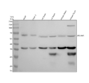 Western blot analysis of PDLIM5 using anti-PDLIM5 antibody. PDLIM5 antibody detects a prominent band at approximately 64 kDa, consistent with the predicted molecular weight of full-length PDZ and LIM domain protein 5. Additional lower-molecular-weight bands at approximately 37 kDa and around 30 kDa are observed, particularly in heart tissue, which are consistent with reported PDLIM5 isoforms and tissue-specific processing described for this protein. Samples were resolved by 10% SDS-PAGE under reducing conditions and transferred to a nitrocellulose membrane. Lane 1: human A549 whole cell lysates; Lane 2: human Caco-2 whole cell lysates; Lane 3: rat brain tissue lysates; Lane 4: rat heart tissue lysates; Lane 5: mouse brain tissue lysates; Lane 6: mouse heart tissue lysates. Detection was performed using HRP-based chemiluminescence.
