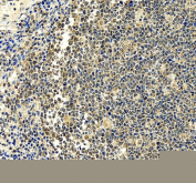 IHC analysis of UBXN1 in human tonsil tissue. UBXN1 expression was examined in a paraffin-embedded section of human tonsil tissue using immunohistochemistry. Heat-mediated antigen retrieval was performed in EDTA buffer (pH 8.0). Sections were blocked with 10% goat serum and incubated with a rabbit anti-UBXN1 antibody overnight at 4Â°C. Detection was performed using an HRP-conjugated secondary antibody with DAB chromogen, and nuclei were counterstained with hematoxylin. UBXN1 staining is observed primarily in lymphoid cells with a cytoplasmic distribution.