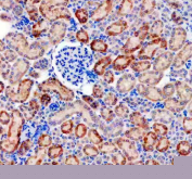 Immunohistochemistry analysis of Platelet-derived growth factor D using PDGF-D antibody. Platelet-derived growth factor D expression was examined in a paraffin-embedded section of mouse kidney tissue. Heat-mediated antigen retrieval was performed using EDTA buffer (pH 8.0). Tissue sections were blocked with normal goat serum and incubated with PDGF-D antibody overnight at 4C. Immunoreactivity was visualized using an HRP-based detection system with DAB chromogen, followed by hematoxylin counterstaining.