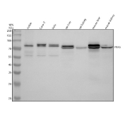 Western blot analysis of PEX5 using PEX5 antibody. Protein lysates from human Jurkat cells (Lane 1), human Caco-2 cells (Lane 2), human HeLa cells (Lane 3), rat liver tissue (Lane 4), rat kidney tissue (Lane 5), mouse liver tissue (Lane 6), and mouse kidney tissue (Lane 7) were resolved by SDS-PAGE under reducing conditions and transferred to a nitrocellulose membrane. PEX5 was detected as bands migrating near 75â80 kDa, consistent with the predicted molecular weight of Peroxisomal biogenesis factor 5 and its known ubiquitinated forms. The presence of closely migrating bands is consistent with mono-ubiquitination of PEX5, which occurs during the peroxisomal protein import cycle. Detection was performed using an HRP-based secondary antibody and chemiluminescent substrate.
