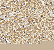Immunohistochemistry analysis of PGAM2 using PGAM2 antibody. PGAM2 expression was examined in a paraffin-embedded section of human heart tissue, with immunoreactivity predominantly observed in cardiomyocytes, consistent with the high metabolic demand of cardiac muscle. Heat-mediated antigen retrieval was performed using EDTA buffer (pH 8.0). Tissue sections were blocked with normal goat serum and incubated with PGAM2 antibody overnight at 4Â°C. Immunoreactivity was visualized using an HRP-based detection system with DAB chromogen, followed by hematoxylin counterstaining.