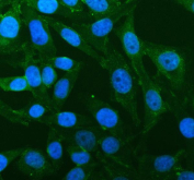 Immunofluorescence analysis of PGAM2 using PGAM2 antibody. PGAM2 expression was examined in human HeLa cells, with signal primarily observed in the cytoplasm, consistent with the cytosolic localization of this glycolytic enzyme. Cells were blocked with normal goat serum and incubated with PGAM2 antibody (green) overnight at 4Â°C. Immunoreactivity was visualized using fluorescence detection, and nuclei were counterstained with DAPI (blue).