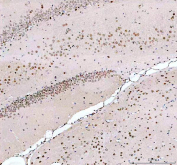Immunohistochemistry analysis of MECP2 using Methyl-CpG-binding protein 2 antibody. MECP2 expression was examined in rat brain tissue, showing nuclear localization in neuronal cell populations. Heat-mediated antigen retrieval was performed using EDTA buffer (pH 8.0). Tissue sections were blocked with normal goat serum and incubated with MECP2 antibody overnight at 4Â°C. Immunoreactivity was visualized using an HRP-based detection system with DAB chromogen, followed by hematoxylin counterstaining.