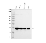 DUT Antibody Human Cell Line WB. Western blot analysis of DUT using anti-DUT antibody demonstrates a predominant immunoreactive band at approximately 18 kDa in human HEL, Jurkat, SH-SY5Y, and HeLa cell lysates. DUT (Deoxyuridine Triphosphatase) is a genome integrity enzyme that regulates intracellular nucleotide pools and prevents inappropriate uracil incorporation into DNA during replication. The observed lower molecular weight species is consistent with the mature nuclear dUTPase isoform, which results from intracellular processing of the DUT precursor protein. DUT is known to exist as multiple isoforms, including nuclear and mitochondrial forms, reflecting its diverse roles in nucleotide metabolism, DNA replication fidelity, and genome maintenance. Predicted molecular weight: ~27 kDa precursor; mature nuclear isoform commonly observed at approximately 18 kDa.