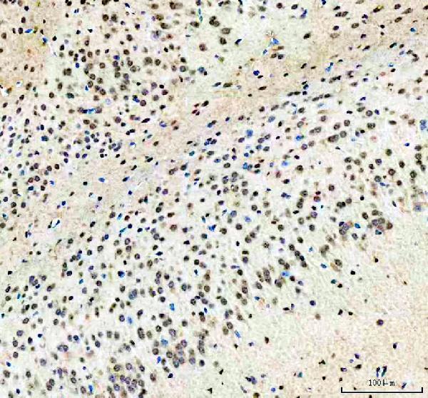 WWTR1 Antibody / Hippo Pathway Effector Antibody Rat Brain IHC. Immunohistochemical staining of FFPE rat brain tissue using WWTR1 Antibody / Hippo Pathway Effector Antibody. WWTR1 expression is detected predominantly within the nuclei of neuronal cells, consistent with its role as a Hippo pathway-regulated transcriptional coactivator involved in neural development, cell fate determination, and transcriptional regulation. Heat-induced epitope retrieval was performed in pH 8.0 EDTA buffer prior to staining. Tissue sections were blocked with 10% goat serum and incubated with the primary antibody (2 ug/ml) overnight at 4Â°C, followed by a peroxidase-conjugated goat anti-rabbit IgG secondary antibody. Immunoreactivity was visualized using an HRP Super Vision detection system with DAB as the chromogen.