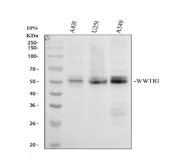 WWTR1 Antibody / Hippo Pathway Effector Antibody Cancer Cell Line WB. Western blot analysis of 1) human A431, 2) human U251, and 3) human A549 whole cell lysates using WWTR1 Antibody / Hippo Pathway Effector Antibody. A specific immunoreactive band is detected at approximately 50 kDa in all three cell lines, consistent with WWTR1 protein expression. The predicted molecular weight of WWTR1 is approximately 44 kDa, with the observed migration likely reflecting post-translational modification or altered electrophoretic mobility.