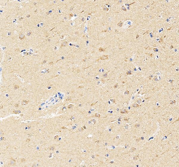 TRIM46 Antibody / Axon Initial Segment Protein Antibody Human Cerebral Cortex IHC. Immunohistochemical staining of FFPE human cerebral cortex tissue using TRIM46 Antibody / Axon Initial Segment Protein Antibody. TRIM46 expression is detected predominantly within neuronal processes and cell bodies, consistent with its role in organizing parallel microtubule bundles at the axon initial segment and establishing neuronal polarity. Heat-induced epitope retrieval was performed in pH 8.0 EDTA buffer prior to staining. Tissue sections were blocked with 10% goat serum and incubated with the primary antibody (2 ug/ml) overnight at 4Â°C, followed by a peroxidase-conjugated goat anti-rabbit IgG secondary antibody. Immunoreactivity was visualized using an HRP Super Vision detection system with DAB as the chromogen.