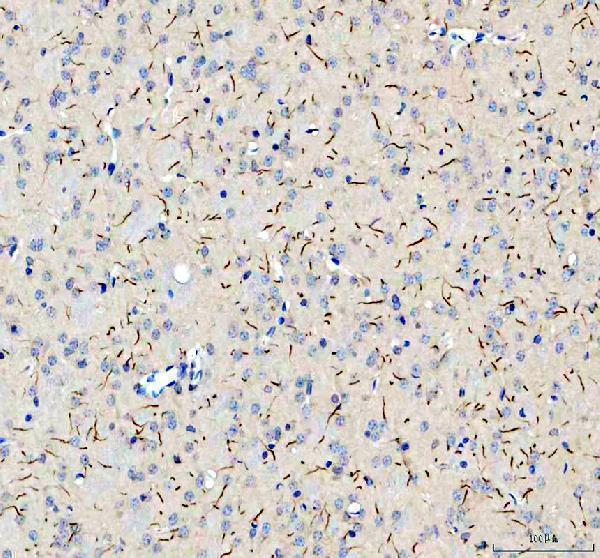 TRIM46 Antibody / Axon Initial Segment Protein Antibody Mouse Brain IHC. Immunohistochemical staining of FFPE mouse brain tissue using TRIM46 Antibody / Axon Initial Segment Protein Antibody. TRIM46 expression is detected predominantly within neuronal processes, consistent with its localization to the axon initial segment where it organizes parallel microtubule bundles and establishes neuronal polarity. Heat-induced epitope retrieval was performed in pH 8.0 EDTA buffer prior to staining. Tissue sections were blocked with 10% goat serum and incubated with the primary antibody (2 ug/ml) overnight at 4Â°C, followed by a peroxidase-conjugated goat anti-rabbit IgG secondary antibody. Immunoreactivity was visualized using an HRP Super Vision detection system with DAB as the chromogen.