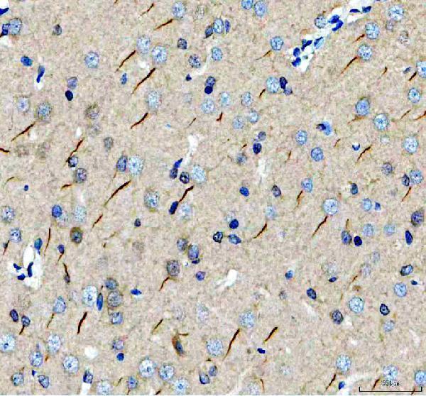 TRIM46 Antibody / Axon Initial Segment Protein Antibody Rat Brain IHC. Immunohistochemical staining of FFPE rat brain tissue using TRIM46 Antibody / Axon Initial Segment Protein Antibody. TRIM46 expression is detected predominantly within axon initial segments of neurons, consistent with its role in organizing parallel microtubule bundles that establish neuronal polarity and support axonal identity. Heat-induced epitope retrieval was performed in pH 8.0 EDTA buffer prior to staining. Tissue sections were blocked with 10% goat serum and incubated with the primary antibody (2 ug/ml) overnight at 4Â°C, followed by a peroxidase-conjugated goat anti-rabbit IgG secondary antibody. Immunoreactivity was visualized using an HRP Super Vision detection system with DAB as the chromogen.