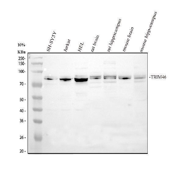 TRIM46 Antibody / Axon Initial Segment Protein Antibody Human, Mouse and Rat WB. Western blot analysis of 1) human SH-SY5Y, 2) human Jurkat, 3) human HEL, 4) rat brain, 5) rat hippocampus, 6) mouse brain, and 7) mouse hippocampus lysates using TRIM46 Antibody / Axon Initial Segment Protein Antibody. A specific immunoreactive band is detected at approximately 83 kDa in all tested samples, consistent with the predicted molecular weight of TRIM46. These results demonstrate reliable detection of TRIM46, a neuron-associated microtubule-organizing protein that is essential for axon initial segment assembly and the establishment of neuronal polarity.