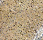 Inverted Formin 2 Antibody Mouse Brain IHC. Immunohistochemistry staining of FFPE mouse brain tissue with Inverted Formin 2 Antibody at 2 ug/ml. HIER was performed using pH 8 EDTA buffer, followed by blocking with 10% goat serum. The tissue section was incubated with rabbit anti-INF2 antibody overnight at 4Â°C, followed by HRP-conjugated goat anti-rabbit IgG secondary antibody and DAB chromogen detection. Inverted Formin 2 Antibody / Formin Protein Antibody demonstrates cytoplasmic staining consistent with INF2 expression and supports studies of actin cytoskeleton remodeling, neuronal cell structure and intracellular organization pathways.