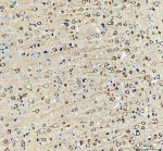Inverted Formin 2 Antibody Rat Brain IHC. Immunohistochemistry staining of FFPE rat brain tissue with Inverted Formin 2 Antibody at 2 ug/ml. HIER was performed using pH 8 EDTA buffer, followed by blocking with 10% goat serum. The tissue section was incubated with rabbit anti-INF2 antibody overnight at 4Â°C, followed by HRP-conjugated goat anti-rabbit IgG secondary antibody and DAB chromogen detection. Inverted Formin 2 Antibody / Formin Protein Antibody demonstrates cytoplasmic staining consistent with INF2 expression and supports studies of actin cytoskeleton remodeling, neuronal cell biology and formin-mediated cellular regulation pathways.