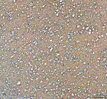 ATP1A3 Antibody Rat Brain Region IHC. Immunohistochemistry staining of FFPE rat brain tissue with ATP1A3 Antibody at 2 ug/ml. HIER was performed using pH 8 EDTA buffer, followed by blocking with 10% goat serum. The tissue section was incubated with rabbit anti-ATP1A3 antibody overnight at 4Â°C, followed by HRP-conjugated goat anti-rabbit IgG secondary antibody and DAB chromogen detection. ATP1A3 Antibody / Sodium Potassium ATPase Antibody demonstrates neuronal staining consistent with ATPase alpha 3 expression and supports studies of sodium potassium pump activity, neuronal ion homeostasis and nervous system signaling pathways.