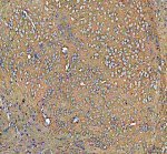 ATP1A3 Antibody Mouse Brain IHC. Immunohistochemistry staining of FFPE mouse brain tissue with ATP1A3 Antibody at 2 ug/ml. HIER was performed using pH 8 EDTA buffer, followed by blocking with 10% goat serum. The tissue section was incubated with rabbit anti-ATP1A3 antibody overnight at 4Â°C, followed by HRP-conjugated goat anti-rabbit IgG secondary antibody and DAB chromogen detection. ATP1A3 Antibody / Sodium Potassium ATPase Antibody demonstrates neuronal staining consistent with ATPase alpha 3 expression and supports studies of ion transport, membrane potential regulation and nervous system signaling pathways.