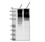 ATP1A3 Antibody Rat and Mouse Brain WB. Western blot testing of rat brain and mouse brain tissue lysates with ATP1A3 Antibody at 0.5 ug/ml. Lane 1: rat brain; Lane 2: mouse brain. ATP1A3 has a predicted molecular weight of approximately 112 kDa and was detected as a major immunoreactive band above the predicted size, consistent with altered electrophoretic migration reported for multi-pass membrane ATPase proteins. ATP1A3 Antibody / Sodium Potassium ATPase Antibody supports studies of neuronal ion transport, membrane excitability and nervous system signaling pathways.