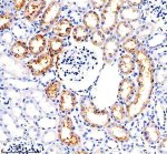 Legumain Antibody Rat Kidney IHC. Immunohistochemistry staining of FFPE rat kidney tissue with Legumain Antibody at 1:50 dilution. HIER was performed using pH 8 EDTA buffer, followed by blocking with 10% goat serum. The tissue section was incubated with rabbit anti-Legumain antibody overnight at 4Â°C, followed by HRP-conjugated goat anti-rabbit IgG secondary antibody and DAB chromogen detection. Legumain Antibody / Asparaginyl Endopeptidase Antibody demonstrates strong tubular staining consistent with LGMN expression and supports studies of lysosomal protease activity, protein processing and cellular regulation pathways.