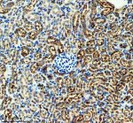 Legumain Antibody Mouse Kidney IHC. Immunohistochemistry staining of FFPE mouse kidney tissue with Legumain Antibody at 1:50 dilution. HIER was performed using pH 8 EDTA buffer, followed by blocking with 10% goat serum. The tissue section was incubated with rabbit anti-Legumain antibody overnight at 4Â°C, followed by HRP-conjugated goat anti-rabbit IgG secondary antibody and DAB chromogen detection. Legumain Antibody / Asparaginyl Endopeptidase Antibody demonstrates strong renal tubular staining consistent with LGMN expression and supports studies of lysosomal cysteine protease activity, protein processing and cell biology pathways.