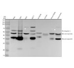 Legumain Antibody Human, Mouse and Rat WB. Western blot testing of human HeLa, human 293T, human K562, human MCF-7, rat kidney, rat brain, mouse kidney and mouse brain lysates with Legumain Antibody at 1:500 dilution. Lane 1: human HeLa; Lane 2: human 293T; Lane 3: human K562; Lane 4: human MCF-7; Lane 5: rat kidney; Lane 6: rat brain; Lane 7: mouse kidney; Lane 8: mouse brain. Multiple bands were detected corresponding to pro-Legumain and mature Legumain forms generated through proteolytic processing. Legumain Antibody / Asparaginyl Endopeptidase Antibody supports studies of lysosomal cysteine protease activity, protein maturation and cellular regulation pathways.