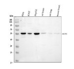 PIST Antibody / Golgi Trafficking Protein Antibody Human Cancer Cell WB. Western blot analysis of human HeLa, K562 and HepG2 cell lysates, rat brain and lung tissue lysates, and mouse brain tissue lysate using PIST Antibody / Golgi Trafficking Protein Antibody. Samples were tested with the primary antibody at 0.5 ug/ml. A specific band was detected at approximately 51 kDa, consistent with the predicted molecular weight of PIST/GOPC. These results support the use of PIST Antibody / Golgi Trafficking Protein Antibody for studying Golgi trafficking protein expression and intracellular protein sorting pathways across human, rat and mouse samples.