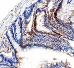 KLF5 Antibody Rat Small Intestine IHC. Immunohistochemical analysis of FFPE rat small intestine tissue using KLF5 Antibody. Heat-induced epitope retrieval was performed in pH 8.0 EDTA buffer prior to incubation with the primary antibody at 2 ug/mL overnight at 4Â°C. An HRP-conjugated goat anti-rabbit secondary antibody with DAB chromogen was used for visualization. Strong nuclear staining is observed predominantly within the epithelial cells of the intestinal crypts, with weaker staining in the differentiated villus epithelium, consistent with the established role of KLF5 in epithelial proliferation and intestinal homeostasis. These results demonstrate that KLF5 Antibody, an Epithelial Transcription Factor Antibody, specifically detects endogenous KLF5 in FFPE rat intestinal tissue.