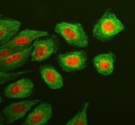 KLF5 Antibody SiHa Cell IF. Immunofluorescent staining of SiHa cells using KLF5 Antibody together with alpha tubulin antibody. Cells underwent enzyme-mediated antigen retrieval for 15 minutes before incubation with KLF5 Antibody at 5 ug/mL and an alpha tubulin antibody overnight at 4Â°C. A Cy3-conjugated goat anti-rabbit secondary antibody was used to detect KLF5 (red), while a Fluoro488-conjugated goat anti-mouse secondary antibody labeled alpha tubulin (green). Prominent nuclear localization of KLF5 is observed within the cytoskeletal framework defined by alpha tubulin, consistent with the expected distribution of this epithelial transcription factor. These results demonstrate that KLF5 Antibody, an Epithelial Transcription Factor Antibody, specifically detects endogenous KLF5 in cultured human cells.
