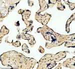 LARS2 Antibody Human Placenta IHC. Immunohistochemical analysis of FFPE human placenta tissue using LARS2 Antibody. Heat-induced epitope retrieval was performed in pH 8.0 EDTA buffer prior to incubation with the primary antibody at 2 ug/mL overnight at 4Â°C. An HRP-conjugated goat anti-rabbit secondary antibody with DAB chromogen was used for visualization. Moderate granular cytoplasmic staining is observed throughout the trophoblast cells, consistent with the expected mitochondrial localization of leucyl-tRNA synthetase 2. These results demonstrate that LARS2 Antibody, a Mitochondrial Leucyl-tRNA Synthetase Antibody, specifically detects endogenous LARS2 in FFPE human placental tissue.