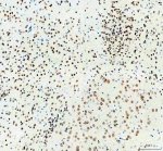 ELAVL1 Antibody Mouse Brain IHC. Immunohistochemical analysis of FFPE mouse brain tissue using ELAVL1 Antibody. Heat-induced epitope retrieval was performed in pH 8.0 EDTA buffer prior to incubation with the primary antibody (1:100) overnight at 4Â°C. An HRP-conjugated goat anti-rabbit secondary antibody with DAB chromogen was used for visualization. Strong nuclear staining is observed throughout neuronal cell populations, with weaker cytoplasmic immunoreactivity in scattered cells, consistent with the characteristic nuclear localization and regulated nucleocytoplasmic shuttling of ELAVL1. These results demonstrate that ELAVL1 Antibody, an ELAV Like RNA Binding Protein 1 Antibody, specifically detects endogenous ELAVL1 in FFPE mouse brain tissue.