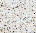 ELAVL1 Antibody Rat Brain IHC. Immunohistochemical analysis of FFPE rat brain tissue using ELAVL1 Antibody. Heat-induced epitope retrieval was performed in pH 8.0 EDTA buffer prior to incubation with the primary antibody (1:100) overnight at 4Â°C. An HRP-conjugated goat anti-rabbit secondary antibody with DAB chromogen was used for visualization. Strong nuclear staining is observed throughout neuronal cell populations with minimal cytoplasmic immunoreactivity, consistent with the characteristic nuclear localization of ELAVL1 and its role in regulating messenger RNA stability. These results demonstrate that ELAVL1 Antibody, an ELAV Like RNA Binding Protein 1 Antibody, specifically detects endogenous ELAVL1 in FFPE rat brain tissue.