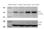 ELAVL1 Antibody Rat Colon Cancer Model WB. Western blot analysis of ELAVL1 Antibody using lysates from 1) normal rat colon tissue, 2) normal rat colon tissue, 3) rat colon cancer model tissue, and 4) rat colon cancer model tissue. Samples (30 ug/lane) were separated on an 8% SDS-PAGE gel under reducing conditions, transferred to a membrane, and detected with ELAVL1 Antibody at a 1:2000 dilution followed by an HRP-conjugated secondary antibody and ECL detection. A specific band is observed at approximately 36â38 kDa, with stronger ELAVL1 expression in the rat colon cancer model samples than in normal colon tissue. Actin served as the loading control. These results demonstrate that ELAVL1 Antibody, an ELAV Like RNA Binding Protein 1 Antibody, specifically detects endogenous ELAVL1 and can distinguish differential expression associated with colorectal tumorigenesis.