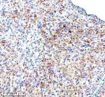 RPS12 Antibody Mouse Ovary IHC. Immunohistochemical analysis of FFPE mouse ovary tissue using RPS12 Antibody. Heat-induced epitope retrieval was performed in pH 8.0 EDTA buffer prior to incubation with the primary antibody (1:100) overnight at 4Â°C. An HRP-conjugated goat anti-rabbit secondary antibody with DAB chromogen was used for visualization. Moderate diffuse cytoplasmic staining is observed throughout the ovarian cells, consistent with the expected cytoplasmic localization of 40S ribosomal protein S12 within actively translating ribosomes. These results demonstrate that RPS12 Antibody, a 40S Ribosomal Protein S12 Antibody, specifically detects endogenous RPS12 in FFPE mouse ovary tissue.