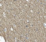 MAG Antibody Human Cerebral Cortex White Matter IHC. Immunohistochemistry was performed on FFPE human cerebral cortex tissue using MAG Antibody. Heat-induced epitope retrieval was carried out in pH 8 EDTA buffer prior to incubation with the primary antibody at 2 ug/ml. Bound antibody was detected using an HRP-conjugated goat anti-rabbit IgG secondary antibody with DAB chromogen. Intense staining is observed throughout the myelinated fiber network within the cortical white matter, while neuronal cell bodies exhibit minimal immunoreactivity, consistent with the localization of Myelin Associated Glycoprotein to oligodendrocyte myelin membranes. These results demonstrate that this Myelin Associated Glycoprotein Antibody is suitable for immunohistochemical detection of endogenous MAG in formalin-fixed, paraffin-embedded human cerebral cortex tissue.