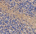MAG Antibody Human Cerebellar White Matter IHC. Immunohistochemistry was performed on FFPE human cerebellum tissue using MAG Antibody. Heat-induced epitope retrieval was carried out in pH 8 EDTA buffer prior to incubation with the primary antibody at 2 ug/ml. Bound antibody was detected using an HRP-conjugated goat anti-rabbit IgG secondary antibody with DAB chromogen. Strong linear staining is concentrated within the myelinated fibers of the cerebellar white matter, with comparatively weaker staining in the adjacent granular layer, consistent with the localization of Myelin Associated Glycoprotein to oligodendrocyte myelin sheaths. These results demonstrate that this Myelin Associated Glycoprotein Antibody is suitable for immunohistochemical detection of endogenous MAG in formalin-fixed, paraffin-embedded human cerebellum tissue.