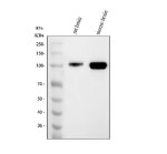 MAG Antibody Rat and Mouse Brain WB. Western blot analysis was performed using MAG Antibody. Lane 1: rat brain tissue lysate; lane 2: mouse brain tissue lysate. A specific immunoreactive band is detected at approximately 100 kDa in both samples, consistent with the heavily glycosylated mature form of Myelin Associated Glycoprotein, which commonly migrates above its predicted molecular weight of approximately 69 kDa. The strong signal in brain tissue reflects the abundant expression of MAG within myelinating oligodendrocytes and myelin-rich regions of the central nervous system. These results demonstrate that this Myelin Associated Glycoprotein Antibody is suitable for Western blot detection of endogenous MAG in rat and mouse brain tissue lysates.
