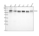 FKHRL1 Antibody Human, Rat and Mouse Cell WB. Western blot analysis was performed using FOXO3A Antibody on lane 1: human 293T, lane 2: human Jurkat, lane 3: human MCF-7, lane 4: human PC-3, lane 5: rat PC-12, and lane 6: mouse Neuro-2a whole cell lysates. A prominent immunoreactive band is detected at approximately 90 kDa in all samples, together with a weaker band at approximately 71â75 kDa, consistent with the predicted molecular weight of FOXO3A. The higher molecular weight species likely reflects post-translationally modified forms of FOXO3A that migrate above the predicted size. Detection across human, rat, and mouse cell lines demonstrates the conserved expression of this forkhead transcription factor. This FKHRL1 Antibody / FOXO3A Antibody is well suited for Western blot studies of FOXO3A expression, PI3K/AKT signaling, transcriptional regulation, apoptosis, and cellular stress responses.