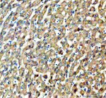 GNMT Antibody Human Liver IHC. Immunohistochemical staining of FFPE human liver tissue following heat-induced epitope retrieval in pH8 EDTA buffer demonstrated GNMT expression using an HRP-conjugated detection system with DAB chromogen. Hepatocytes exhibit diffuse moderate to strong cytoplasmic staining, consistent with the high physiological expression of glycine N-methyltransferase in normal liver. The staining pattern supports the use of GNMT Antibody, a Glycine N-Methyltransferase Antibody, for immunohistochemical detection of GNMT expression in human liver tissue.