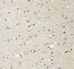 PACAP Antibody Human Cerebral Cortex IHC. Immunohistochemical staining of FFPE human cerebral cortex tissue using PACAP antibody following heat-induced epitope retrieval in pH8 EDTA buffer. Staining was visualized using an HRP secondary antibody with DAB chromogen. Predominantly cytoplasmic staining is observed in cortical neurons with lighter background staining throughout the surrounding neuropil, consistent with the neuronal expression pattern of the neuropeptide PACAP. This result demonstrates that the PACAP antibody is suitable for detecting endogenous PACAP in FFPE human brain tissue.