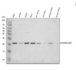 PACAP Antibody Human, Rat and Mouse WB. Western blot analysis of human HEL, Jurkat, K562, and HeLa cell lysates, along with rat testis, rat brain, mouse testis, and mouse brain tissue lysates using PACAP antibody. Lane 1: human HEL; Lane 2: human Jurkat; Lane 3: human K562; Lane 4: human HeLa; Lane 5: rat testis; Lane 6: rat brain; Lane 7: mouse testis; Lane 8: mouse brain. A specific band is detected at approximately 21 kDa across multiple samples. Although the predicted molecular weight of the ADCYAP1 precursor is approximately 19 kDa, migration at approximately 21-25 kDa has been reported and may reflect precursor processing, post-translational modification, or differences in electrophoretic mobility. This result demonstrates that the PACAP antibody is suitable for detecting endogenous neuropeptide precursor expression in both human and rodent cells and tissues.