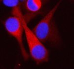 SRBI Antibody HeLa Cell IF. Immunofluorescence staining of HeLa cells with SRBI Antibody demonstrated predominantly cytoplasmic and plasma membrane-associated staining (red), while nuclei were counterstained with DAPI (blue). Cells underwent enzyme-mediated antigen retrieval before incubation with the primary antibody and a Cy3-conjugated secondary antibody. The staining pattern is consistent with the localization of SRBI as an HDL Receptor Antibody target involved in cholesterol uptake and lipoprotein transport, supporting its use for immunofluorescence studies of lipid metabolism and membrane receptor biology.