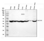 SLC17A7 Antibody Human, Mouse and Rat WB. Western blot analysis detected SLC17A7 in human K562 (lane 1), U2OS (lane 2), SH-SY5Y (lane 3) and U251 (lane 4) cell lysates, as well as rat brain (lane 5), rat eye (lane 6) and mouse brain (lane 7). A predominant immunoreactive band was observed at approximately 53 kDa, slightly lower than the predicted molecular weight of 62 kDa, consistent with previously reported migration of SLC17A7. Strong expression in brain tissues reflects the abundant presence of this glutamate transporter in excitatory neurons. This SLC17A7 Antibody, a Glutamate Transporter Antibody, demonstrates cross-species reactivity and is suitable for studies of glutamatergic neurotransmission, synaptic vesicle biology and neuronal function.