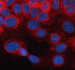 GBP2 Antibody Human A431 IF. Immunofluorescent staining of A431 human epidermoid carcinoma cells using GBP2 Antibody (red) following enzyme-mediated antigen retrieval and DAPI nuclear counterstaining (blue). GBP2 displays predominantly cytoplasmic staining with a punctate distribution, consistent with its localization as an interferon-inducible large GTPase involved in innate immune signaling and host defense. This result demonstrates the utility of GBP2 Antibody, an Interferon Induced GTPase Antibody, for investigating GBP2 localization and interferon-mediated immune responses in cultured human cells.