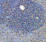 GBP2 Antibody Rat Spleen IHC. Immunohistochemical staining of FFPE rat spleen tissue using GBP2 Antibody at 2 ug/ml with HRP/DAB detection following heat-induced epitope retrieval in pH8 EDTA buffer. Distinct cytoplasmic staining is observed in splenic immune cells, consistent with the expected expression of the interferon-inducible GTPase GBP2 in lymphoid tissue. This staining pattern demonstrates the utility of GBP2 Antibody, an Interferon Induced GTPase Antibody, for investigating innate immune responses, interferon signaling and immune cell activation in tissue sections.