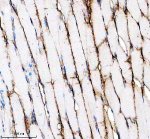 SGCD Antibody Rat Skeletal Muscle IHC. Immunohistochemical analysis of FFPE rat skeletal muscle tissue using SGCD Antibody / Sarcoglycan Family Protein Antibody, clone AbS97. Heat-induced epitope retrieval was performed in EDTA buffer (pH 8.0). The tissue was incubated with the recombinant rabbit monoclonal antibody at a 1:50 dilution overnight at 4Â°C, followed by an HRP-conjugated goat anti-rabbit secondary antibody and DAB chromogen detection. Strong membranous staining is observed outlining skeletal muscle fibers, consistent with the expected sarcolemmal localization of SGCD in muscle tissue. This SGCD Antibody, also called Sarcoglycan Family Protein Antibody, is suitable for studies of sarcoglycan biology, muscle membrane stability, dystrophin-associated protein complexes, and skeletal and cardiac muscle physiology.