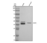 SGCD Antibody Human A549 Cell and Rat Heart WB. Western blot analysis of human A549 whole cell lysate (lane 1) and rat heart tissue lysate (lane 2) using SGCD Antibody / Sarcoglycan Family Protein Antibody, clone AbS97. Proteins were separated on a 10% SDS-PAGE gel, transferred to a nitrocellulose membrane, and incubated with the recombinant rabbit monoclonal antibody at a 1:500 dilution, followed by an HRP-conjugated goat anti-rabbit secondary antibody for chemiluminescent detection. A specific band was detected at approximately 38 kDa in both samples, consistent with SGCD expression, although the predicted molecular weight is approximately 32 kDa. This SGCD Antibody, also called Sarcoglycan Family Protein Antibody, is suitable for studies of sarcoglycan biology, muscle membrane stability, dystrophin-associated protein complexes, and skeletal and cardiac muscle physiology.