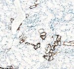 SLC8A1 Antibody Human Kidney IHC. Immunohistochemical analysis of FFPE human kidney tissue using SLC8A1 Antibody / NCX1 Antibody, clone 18S76. Heat-induced epitope retrieval was performed in EDTA buffer (pH 8.0). The tissue was incubated with the recombinant rabbit monoclonal antibody at a 1:50 dilution overnight at 4Â°C, followed by an HRP-conjugated goat anti-rabbit secondary antibody and DAB chromogen detection. Strong membranous staining is observed in renal tubular epithelial cells, consistent with the known localization of SLC8A1 in the kidney, where it regulates sodium-calcium exchange and cellular calcium homeostasis. This SLC8A1 Antibody, also called NCX1 Antibody, is suitable for studies of sodium-calcium exchange, calcium homeostasis, renal physiology, membrane transporter biology, and cardiovascular research.