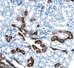 SLC8A1 Antibody Mouse Kidney IHC. Immunohistochemical analysis of FFPE mouse kidney tissue using SLC8A1 Antibody / NCX1 Antibody, clone 18S76. Heat-induced epitope retrieval was performed in EDTA buffer (pH 8.0). The tissue was incubated with the recombinant rabbit monoclonal antibody at a 1:50 dilution overnight at 4Â°C, followed by an HRP-conjugated goat anti-rabbit secondary antibody and DAB chromogen detection. Prominent membranous and cytoplasmic staining is observed in renal tubular epithelial cells, consistent with the known expression of SLC8A1 in kidney tissue and its role in sodium-calcium exchange. This SLC8A1 Antibody, also called NCX1 Antibody, is suitable for studies of sodium-calcium exchange, calcium homeostasis, renal physiology, membrane transporter biology, and cardiovascular research.