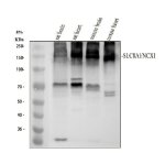 SLC8A1 Antibody Mouse and Rat Brain and Heart WB. Western blot analysis of rat brain (lane 1), rat heart (lane 2), mouse brain (lane 3), and mouse heart (lane 4) tissue lysates using SLC8A1 Antibody / NCX1 Antibody, clone 18S76. Proteins were separated on an 8% SDS-PAGE gel, transferred to a nitrocellulose membrane, and incubated with the recombinant rabbit monoclonal antibody at a 1:500 dilution, followed by an HRP-conjugated goat anti-rabbit secondary antibody for chemiluminescent detection. A prominent band was detected at approximately 140 kDa in all four tissues, consistent with the higher apparent molecular weight commonly observed for glycosylated NCX1 despite a predicted molecular weight of approximately 109 kDa. This SLC8A1 Antibody, also called NCX1 Antibody, is suitable for studies of sodium-calcium exchange, calcium homeostasis, cardiac physiology, membrane transporter biology, and neuronal signaling.