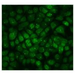 PPM1E Antibody Human A431 Cell IF. Immunofluorescent staining of A431 cells using PPM1E Antibody / Protein Phosphatase 1E Antibody (green). Enzymatic antigen retrieval was performed for 15 minutes before incubation with PPM1E Antibody at 2 ug/ml, followed by a DyLight 488-conjugated goat anti-rabbit secondary antibody. Cells were counterstained with DAPI to visualize nuclei. PPM1E displays predominantly cytoplasmic staining with punctate intracellular labeling, consistent with its role as a PP2C family serine/threonine phosphatase that regulates phosphorylation-dependent signaling pathways. This PPM1E Antibody, also called Protein Phosphatase 1E Antibody, is suitable for studies of protein dephosphorylation, MAPK signaling, neuronal signaling, and cancer-associated signal transduction.